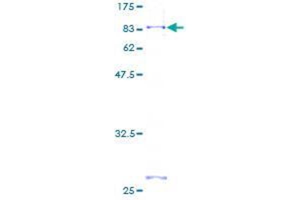 FGFRL1 Protein (AA 1-504) (GST tag)