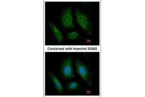 ICC/IF Image Immunofluorescence analysis of paraformaldehyde-fixed HeLa, using OSBPL6, antibody at 1:200 dilution. (OSBPL6 antibody  (C-Term))
