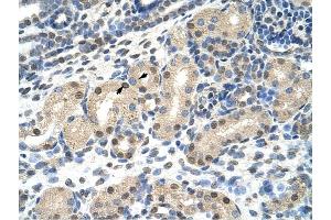 MLXIPL antibody was used for immunohistochemistry at a concentration of 4-8 ug/ml to stain Epithelial cells of renal tubule (arrows) in Human Kidney. (MLXIPL antibody  (N-Term))