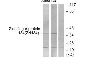Western blot analysis of extracts from COS-7 cells and K562 cells, using ZNF134 antibody. (ZNF134 antibody  (Internal Region))