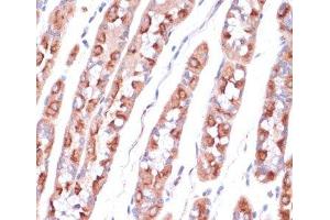 Immunohistochemistry of paraffin-embedded Human stomach using UBE2O Polyclonal Antibody at dilution of 1:100 (40x lens).