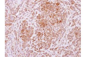 IHC-P Image Immunohistochemical analysis of paraffin-embedded A549 xenograft, using USP4, antibody at 1:500 dilution. (USP4 antibody  (Center))