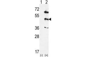 Western Blotting (WB) image for anti-Mitogen-Activated Protein Kinase 12 (MAPK12) antibody (ABIN5023083) (MAPK12 antibody)