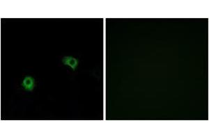 Immunofluorescence analysis of A549 cells, using GPR116 Antibody. (G Protein-Coupled Receptor 116 antibody  (AA 1121-1170))