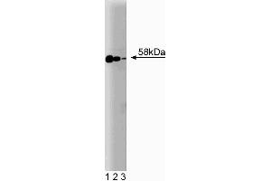 Western blot analysis of Smad2/3 on Jurkat cell lysate. (Smad2/3 antibody  (AA 142-263))