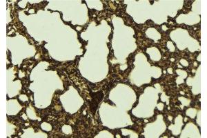 ABIN6276289 at 1/100 staining Mouse lung tissue by IHC-P.