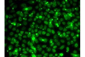 Immunofluorescence analysis of MCF7 cells using RP antibody (ABIN6128654, ABIN6147085, ABIN6147087 and ABIN6218282). (RPA3 antibody  (AA 6-121))