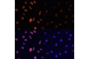 Immunofluorescence (IF) image for anti-Histone H2B (acLys12) antibody (ABIN7267731)