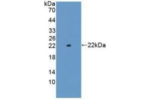 Detection of Recombinant Glucagon, Mouse using Polyclonal Antibody to Glucagon (GCG) (Glucagon antibody  (AA 21-180))