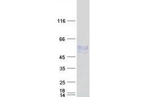 Validation with Western Blot (ENPP6 Protein (Myc-DYKDDDDK Tag))