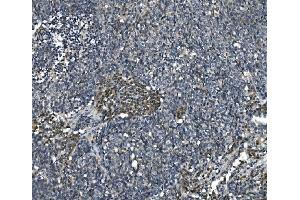 IHC analysis of eRF1/ETF1 using anti-eRF1/ETF1 antibody (ABIN7602626). (ETF1 antibody  (AA 9-342))