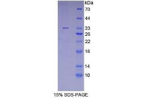 SDS-PAGE (SDS) image for Meningioma Expressed Antigen 5 (Hyaluronidase) (MGEA5) (AA 319-450) protein (His tag) (ABIN2121720)
