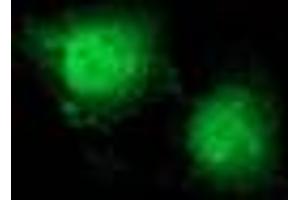 Image no. 9 for anti-Catenin (Cadherin-Associated Protein), beta 1, 88kDa (CTNNB1) antibody (ABIN1496890) (CTNNB1 antibody)