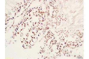 Formalin-fixed and paraffin embedded rat testis labeled with Rabbit Anti-MAP1LC3A(Ser12) Polyclonal Antibody, Unconjugated (ABIN710591) at 1:200 followed by conjugation to the secondary antibody and DAB staining (MAP1LC3A antibody  (pSer12))