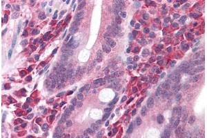 Immunohistochemistry (Formalin-fixed Paraffin-embedded Sections) (IHC (fp)) image for anti-Solute Carrier Family 20 (Phosphate Transporter), Member 1 (SLC20A1) (AA 262-517) antibody (ABIN604920)
