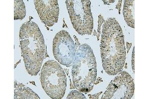 IHC analysis of PDCD6IP using anti-PDCD6IP antibody (ABIN7600490).