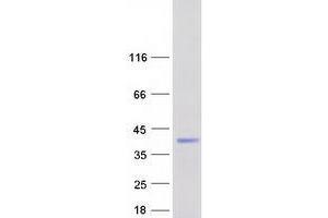 Validation with Western Blot (ZCCHC17 Protein (Myc-DYKDDDDK Tag))