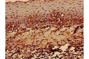 Immunohistochemistry of paraffin-embedded human tonsil tissue using ABIN7155625 at dilution of 1:100 (HLA-C antibody  (AA 25-308))