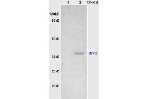 L1 rat brain, L2 human colon carcinoma lysates probed (ABIN732758) at 1:200 in 4 °C. (Cathepsin H antibody  (AA 71-170))