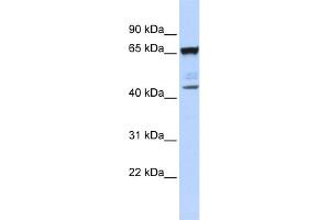 WB Suggested Anti-SCML4 Antibody Titration:  0. (SCML4 antibody  (N-Term))