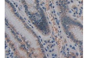 Immunohistochemistry (IHC) image for anti-Glycosylphosphatidylinositol Specific phospholipase D1 (GPLD1) (AA 496-840) antibody (ABIN7436591)