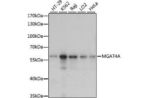 Western blot analysis of extracts of various cell lines, using MGA antibody (ABIN7268393) at 1:1000 dilution.