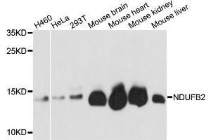 Western blot analysis of extracts of various cell lines, using NDUFB2 antibody. (NDUFB2 antibody)