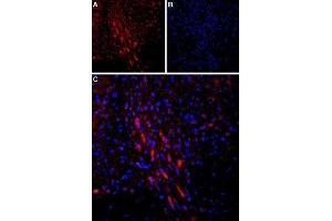 Expression of Parathyroid hormone receptor 1 in rat brain - Immunohistochemical staining of rat dorsal Raphe nucleus using Anti-PTH1R (extracellular) Antibody (ABIN7043429, ABIN7045112 and ABIN7045113). (PTH1R antibody  (Extracellular))