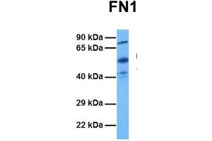 Host:  Rabbit  Target Name:  FN1  Sample Tissue:  Human Ovary Tumor  Antibody Dilution:  1. (Fibronectin 1 antibody  (C-Term))