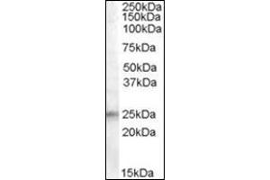 Western Blot: Antibody (0. (IGFBP6 antibody  (Internal Region))