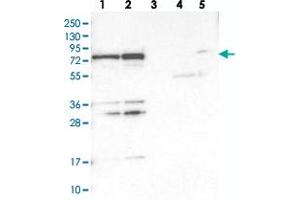 Western blot analysis of Lane 1: RT-4, Lane 2: U-251 MG, Lane 3: Human Plasma, Lane 4: Liver, Lane 5: Tonsil with PTCD1 polyclonal antibody . (PTCD1 antibody)