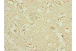 Immunohistochemistry of paraffin-embedded human brain tissue using ABIN7164317 at dilution of 1:100 (DHTKD1 antibody  (AA 1-280))