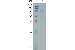 Cadherin 11 (CDH11) (AA 54-617) protein (His tag)