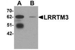 Western blot analysis of LRRTM3 in mouse brain tissue lysate with LRRTM3 antibody at 0. (LRRTM3 antibody  (C-Term))