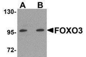 Western Blotting (WB) image for anti-Forkhead Box O3 (FOXO3) (N-Term) antibody (ABIN2473691) (FOXO3 antibody  (N-Term))