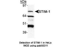 Image no. 1 for anti-Stromal Interaction Molecule 1 (STIM1) (AA 600-685), (C-Term) antibody (ABIN363620) (STIM1 antibody  (C-Term))