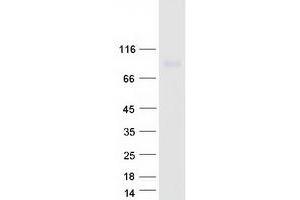 Validation with Western Blot (ITFG1 Protein (Myc-DYKDDDDK Tag))