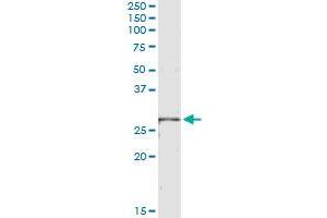 Immunoprecipitation of LRRK1 transfected lysate using anti-LRRK1 monoclonal antibody and Protein A Magnetic Bead , and immunoblotted with LRRK1 MaxPab rabbit polyclonal antibody. (LRRK1 antibody  (AA 560-659))