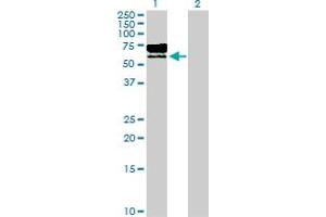 Western Blot analysis of TPP1 expression in transfected 293T cell line by TPP1 MaxPab polyclonal antibody.