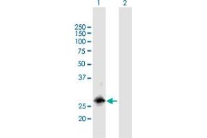 Western Blot analysis of RBM38 expression in transfected 293T cell line by RBM38 MaxPab polyclonal antibody. (RBM38 antibody  (AA 1-239))