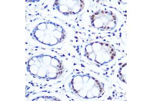Immunohistochemistry of paraffin-embedded human colon using // Rabbit mAb (ABIN7265650) at dilution of 1:100 (40x lens). (APEX1 antibody)