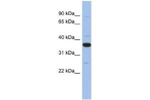 MYD88 antibody used at 1 ug/ml to detect target protein. (MYD88 antibody)