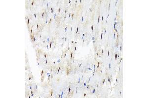 Immunohistochemistry of paraffin-embedded rat heart using SF3B3/S Rabbit mAb (ABIN7270544) at dilution of 1:100 (40x lens). (SF3B3 antibody)