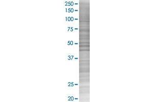 SLC25A3 transfected lysate. (SLC25A3 293T Cell Transient Overexpression Lysate(Denatured))