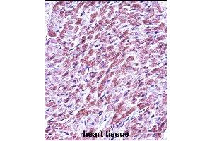 SD3 Antibody (Center) (ABIN657463 and ABIN2846491) immunohistochemistry analysis in forlin fixed and paraffin embedded hun heart tissue followed by peroxidase conjugation of the secondary antibody and DAB staining. (SMAD3 antibody  (AA 127-156))