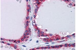 Human Thyroid: Formalin-Fixed, Paraffin-Embedded (FFPE) (PLIN3 antibody  (AA 1-435))