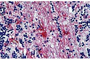 Human Cerebellum: Formalin-Fixed, Paraffin-Embedded (FFPE) (GFAP antibody)
