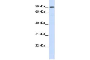 WB Suggested Anti-HKR1 Antibody Titration:  0. (HKR1 antibody  (N-Term))
