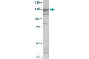 SRGAP1 monoclonal antibody (M07), clone 5D10.