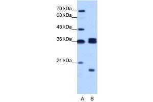 WB Suggested Anti-HNRPH3  Antibody Titration: 1. (HNRNPH3 antibody  (N-Term))